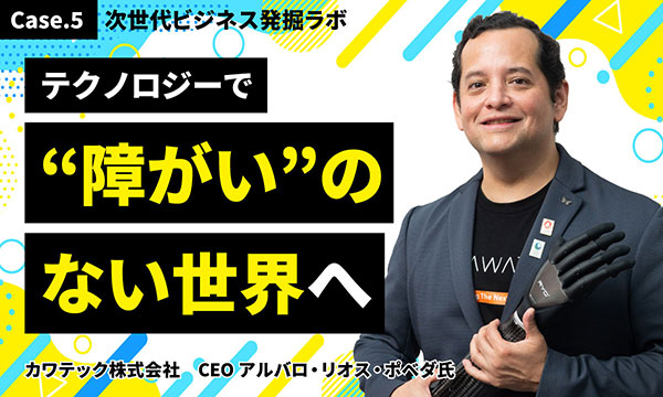 義肢はAIで「自ら考える」時代へ 高度なバイオニクスで人体の能力拡張